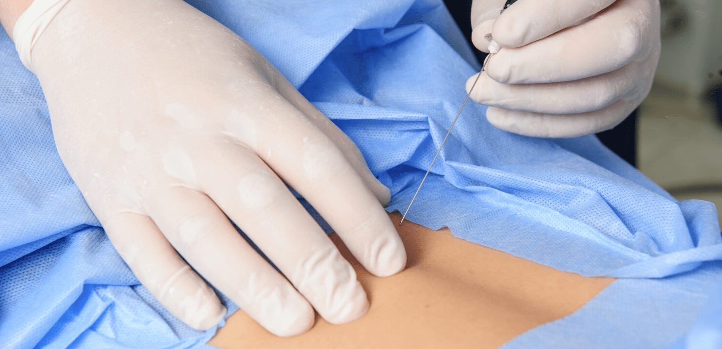 Medial Branch Blocks